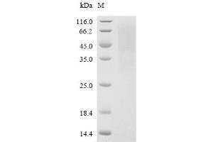 (Tris-Glycine gel) Discontinuous SDS-PAGE (reduced) with 5 % enrichment gel and 15 % separation gel.