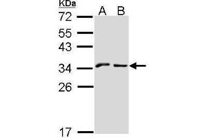 WB Image Sample (30 ug of whole cell lysate) A: A431 , B: Hep G2 , 12% SDS PAGE NKG2-A (CD159a) antibody antibody diluted at 1:1000 (KLRC1 anticorps  (N-Term))