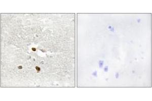 Immunohistochemistry analysis of paraffin-embedded human brain tissue, using ZNF287 Antibody. (ZNF287 anticorps  (AA 241-290))