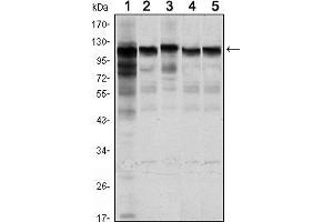 Western blot analysis using HK1 mouse mAb against Jurkat (1), Hela (2), HepG2 (3), MCF-7 (4) and PC-12 (5) cell lysate. (Hexokinase 1 anticorps)