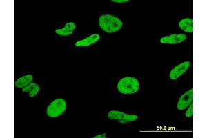 Immunofluorescence of monoclonal antibody to HNRNPA1 on HeLa cell.