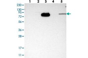 Western blot analysis of Lane 1: RT-4, Lane 2: U-251 MG, Lane 3: Human Plasma, Lane 4: Liver, Lane 5: Tonsil with HJURP polyclonal antibody  at 1:250-1:500 dilution.