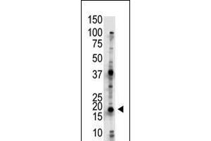 Antibody is used in Western blot to detect UBE2G2 in Jurkat cell lysate. (UBE2G2 anticorps  (N-Term))