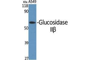 Western Blot (WB) analysis of specific cells using Glucosidase IIbeta Polyclonal Antibody. (GBA2 anticorps  (Internal Region))