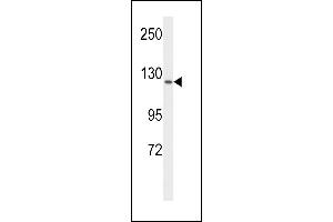 Western blot analysis of VGFR1 Antibody (ABIN653260 and ABIN2842780) in MCF-7 cell line lysates (35 μg/lane). (FLT1 anticorps)