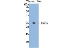 Western Blotting (WB) image for anti-Osteoclast Stimulating Factor 1 (OSTF1) (AA 10-215) antibody (ABIN1860107) (OSTF1 anticorps  (AA 10-215))