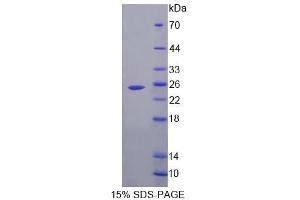 SDS-PAGE analysis of Rat FBL Protein.