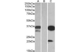 HEK293 lysate (10ug protein in RIPA buffer) over expressing Human DAPP1 with DYKDDDDK tag probed with ABIN768627 (0. (DAPP1 anticorps  (Internal Region))