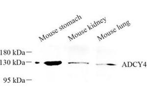 Western blot analysis of ADCY4 (ABIN7072959) at dilution of 1: 250 (ADCY4 anticorps)