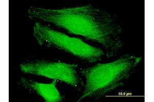 Immunofluorescence of purified MaxPab antibody to TUSC4 on HeLa cell. (NPRL2 anticorps  (AA 1-380))