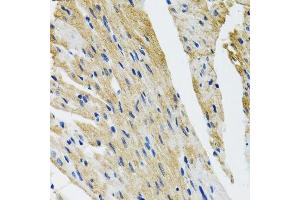 Immunohistochemistry of paraffin-embedded mouse heart using COPB2 antibody. (COPB2 anticorps  (AA 657-906))