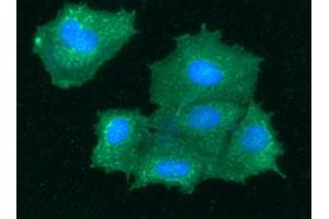 ICC/IF analysis of BHMT in Hep3B cells line, stained with DAPI (Blue) for nucleus staining and monoclonal anti-human BHMT antibody (1:100) with goat anti-mouse IgG-Alexa fluor 488 conjugate (Green).