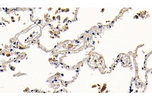 Detection of PGLYRP1 in Human Lung Tissue using Polyclonal Antibody to Peptidoglycan Recognition Protein 1 (PGLYRP1)