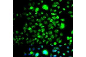 Immunofluorescence analysis of A549 cells using PEX14 Polyclonal Antibody (PEX14 anticorps)