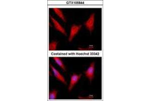 Image no. 3 for anti-Vitamin K-dependent protein C (PROC) (AA 1-236) antibody (ABIN1500426)