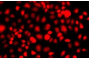 Immunofluorescence analysis of A549 cells using NR2E1 Polyclonal Antibody