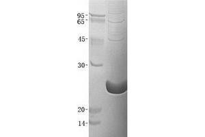 Validation with Western Blot (CLEC3B Protein (His tag))