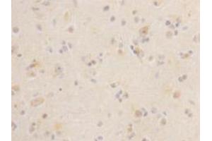 Immunohistochemistry (Paraffin-embedded Sections) (IHC (p)) image for anti-Leucine-Rich Repeat Containing G Protein-Coupled Receptor 5 (LGR5) antibody (ABIN1854936) (LGR5 anticorps)
