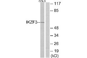 Western blot analysis of extracts from COLO cells, using IKZF3 antibody. (IKZF3 anticorps)