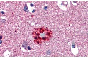 Immunohistochemistry with Human Brain, cortex, senile plaque tissue at an Antibody concentration of 5.
