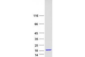 Validation with Western Blot