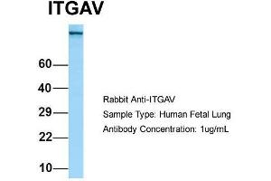 Host: Rabbit  Target Name: ITGAV  Sample Tissue: Human Fetal Lung  Antibody Dilution: 1. (CD51 anticorps  (C-Term))