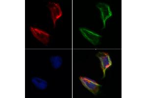 ABIN6264958 and ABIN6273159 staining Hela by IF/ICC. (SEC24A anticorps  (Internal Region))