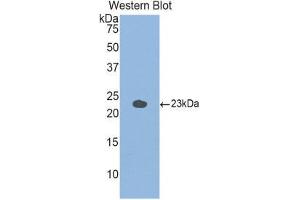 Western Blotting (WB) image for anti-Glucosidase, Alpha, Acid (GAA) (AA 755-953) antibody (ABIN1858938) (GAA anticorps  (AA 755-953))