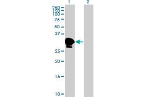 Western Blot analysis of ZNF396 expression in transfected 293T cell line by ZNF396 monoclonal antibody (M01), clone 2F8. (ZNF396 anticorps  (AA 131-230))