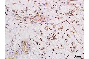 Formalin-fixed and paraffin embedded human enterocolitis labeled with Anti PARG1/Rho GTPase activating protein 29 Polyclonal Antibody, Unconjugated (ABIN762401) followed by conjugation to the secondary antibody and DAB staining (PARG1 anticorps  (AA 301-400))
