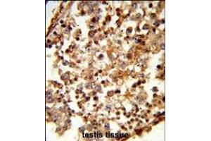 anti-Complement C1q Tumor Necrosis Factor-Related Protein 6 (C1QTNF6) (AA 27-53), (N-Term) antibody