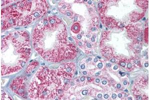 Human Kidney (formalin-fixed, paraffin-embedded) stained with TIRAP antibody ABIN213995 at 2 ug/ml followed by biotinylated goat anti-rabbit IgG secondary antibody ABIN481713, alkaline phosphatase-streptavidin and chromogen. (TIRAP anticorps  (C-Term))