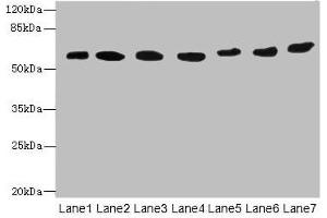 Western blot All lanes: ATL2 antibody at 1 μg/mL Lane 1: HepG2 whole cell lysate Lane 2: MCF-7 whole cell lysate Lane 3: HL60 whole cell lysate Lane 4: K562 whole cell lysate Lane 5: U251 whole cell lysate Lane 6: A549 whole cell lysate Lane 7: A431 whole cell lysate Secondary Goat polyclonal to rabbit IgG at 1/10000 dilution Predicted band size: 67, 47, 66, 65 kDa Observed band size: 67 kDa (ATL2 anticorps  (AA 1-300))