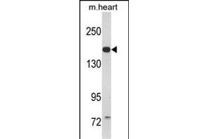 Western blot analysis of CORIN Antibody (Center) (ABIN390854 and ABIN2841076) in mouse heart tissue lysates (35 μg/lane). (Corin anticorps  (AA 459-490))
