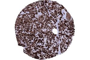 Normal pancreas with strong CELA3B positivity of acinar cells (Recombinant Elastase 3B anticorps  (AA 82-238))
