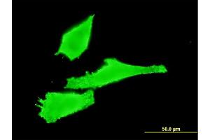 anti-RAB42, Member RAS Oncogene Family (RAB42) (AA 46-105) antibody