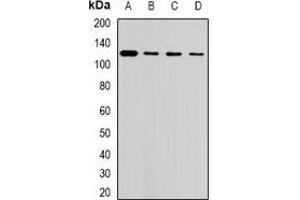 Western blot analysis of USP26 expression in Hela (A), U937 (B), mouse testis (C), rat liver (D) whole cell lysates. (USP26 anticorps)