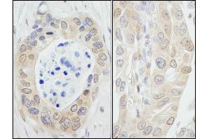 Immunohistochemistry (IHC) image for anti-N-Myc (And STAT) Interactor (NMI) (C-Term) antibody (ABIN7454518)