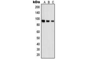 Western blot analysis of PSMD2 expression in Jurkat (A), A431 (B), NIH3T3 (C) whole cell lysates.