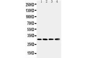 Anti-Superoxide Dismutase 3 antibody, Western blotting Lane 1: Human Placenta Tissue Lysate Lane 2: A549 Cell Lysate Lane 3: MM231 Cell Lysate Lane 4: MCF-7 Cell Lysate (SOD3 anticorps  (N-Term))