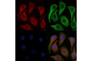 ABIN6257816 and ABIN6275213 staining Hela cells by IF/ICC.