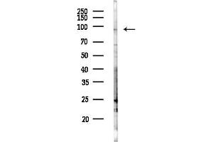 anti-Nucleolar Protein 1 (NOL1) antibody