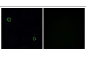 Immunofluorescence analysis of A549 cells, using CXCR4 Antibody. (CXCR4 anticorps  (C-Term))