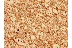 Immunohistochemistry analysis of human brain tissue using ABIN7147533 at dilution of 1:100