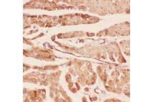 IHC-P testing of rat heart tissue (Desmin anticorps  (AA 1-304))