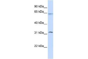 METT10D antibody used at 0. (METTL16 anticorps  (N-Term))