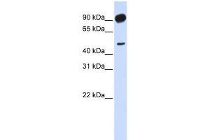 WB Suggested Anti-ADD2 Antibody Titration: 0. (ADD2 anticorps  (Middle Region))