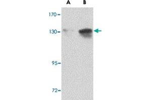 Western blot analysis of NUP155 in P815 cell lysate with NUP155 polyclonal antibody  at (A) 0. (NUP155 anticorps  (C-Term))