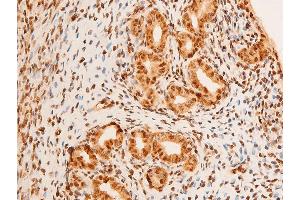 ABIN6267306 at 1/100 staining rat uterine tissue sections by IHC-P.