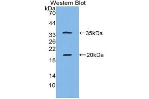Detection of Recombinant SPINK5, Human using Polyclonal Antibody to Serine Peptidase Inhibitor Kazal Type 5 (SPINK5) (SPINK5 anticorps  (AA 699-976))